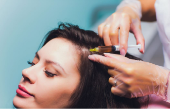 prp therapy for hair fall